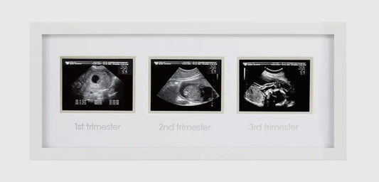 Trimester sonogram frame